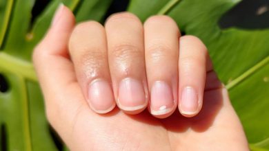 Фото - Почему появляются белые пятна на ногтях и что с этим делать