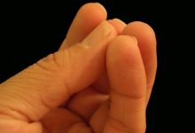 Фото - Всего четыре правила: дерматолог раскрыла секрет здоровых ногтей