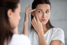 Фото - Как бороться с расширенными порами на лице: советы дерматологов